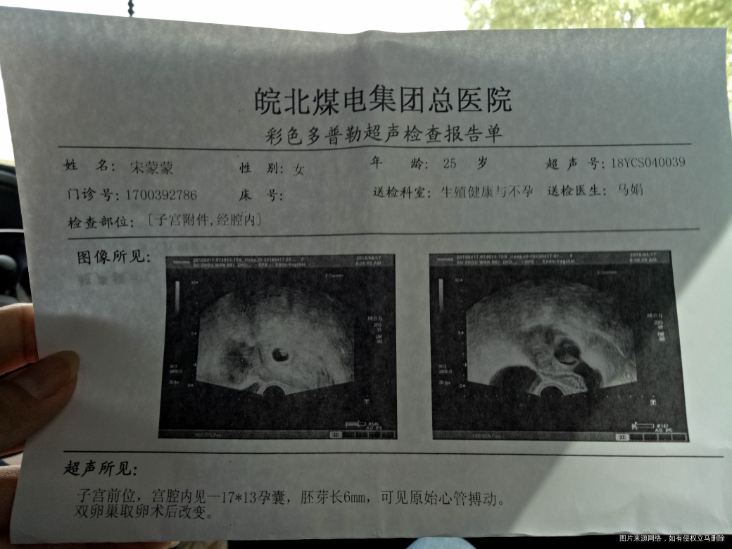 现在可以放心一些了 希望宝宝健康平安