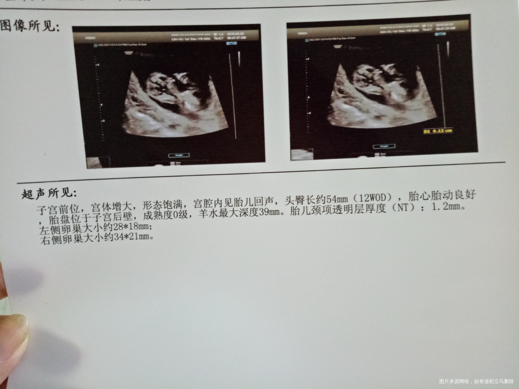 顺利nt归来 宝贝棒棒哒