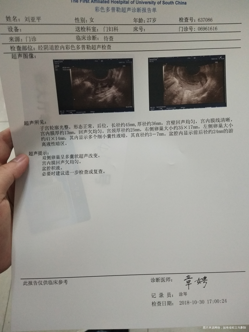 检查出来了,医生说没有排卵……