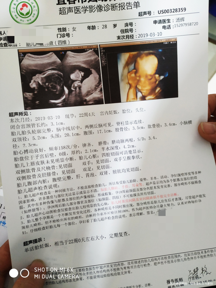 刚刚照好四维彩超,不配合还得复查