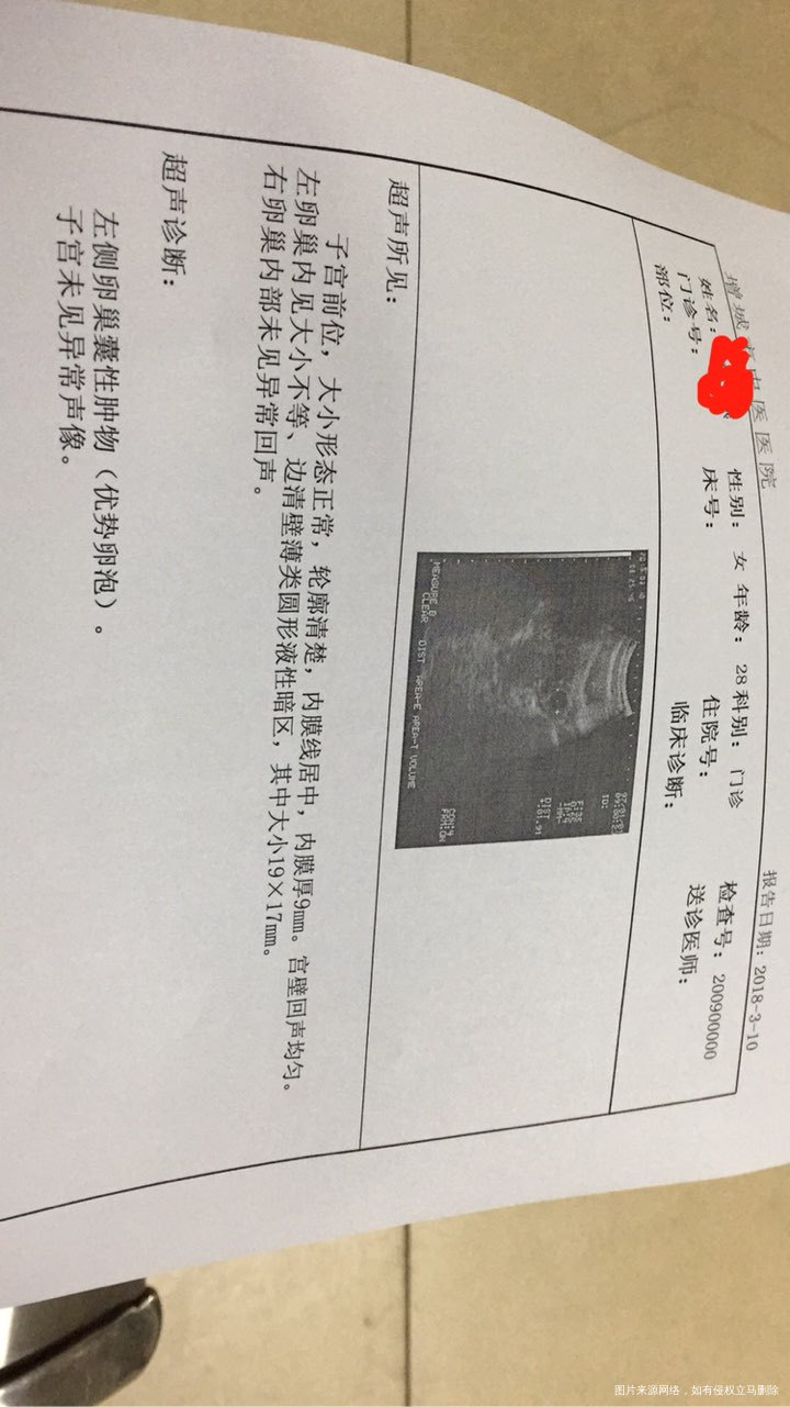 周期第二十天,今天检测的排卵了,昨晚安排了