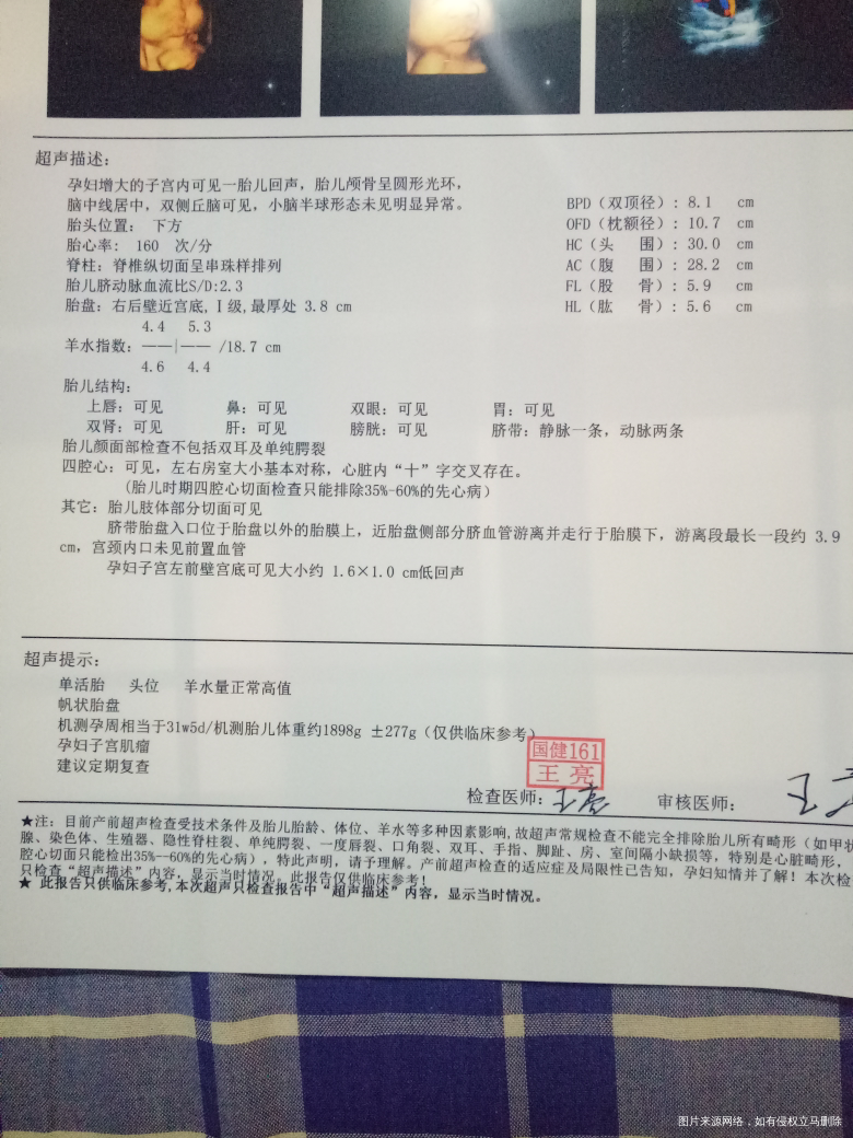 麻烦帮我看看帆状胎盘严重性