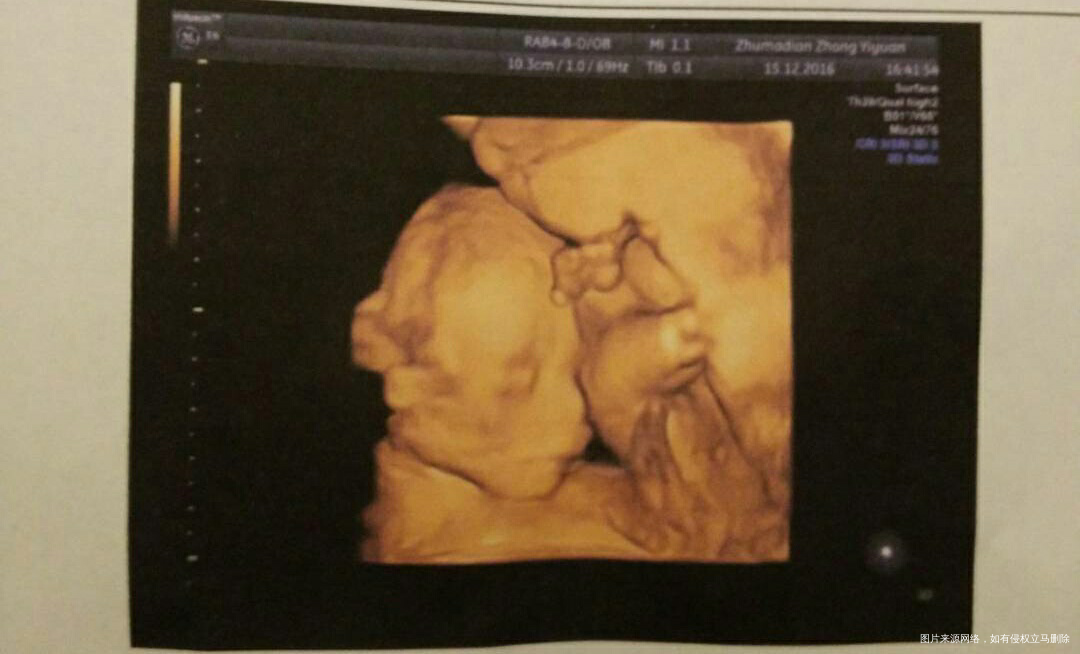 【我家宝爸带娃最有趣】第一次当没经验~