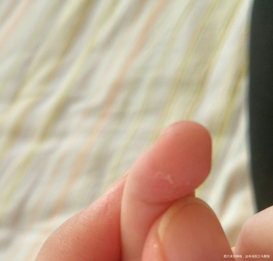 医生帮忙看看宝宝手指头