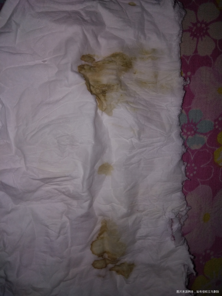 放冻胚第16天,下面留淡黄色