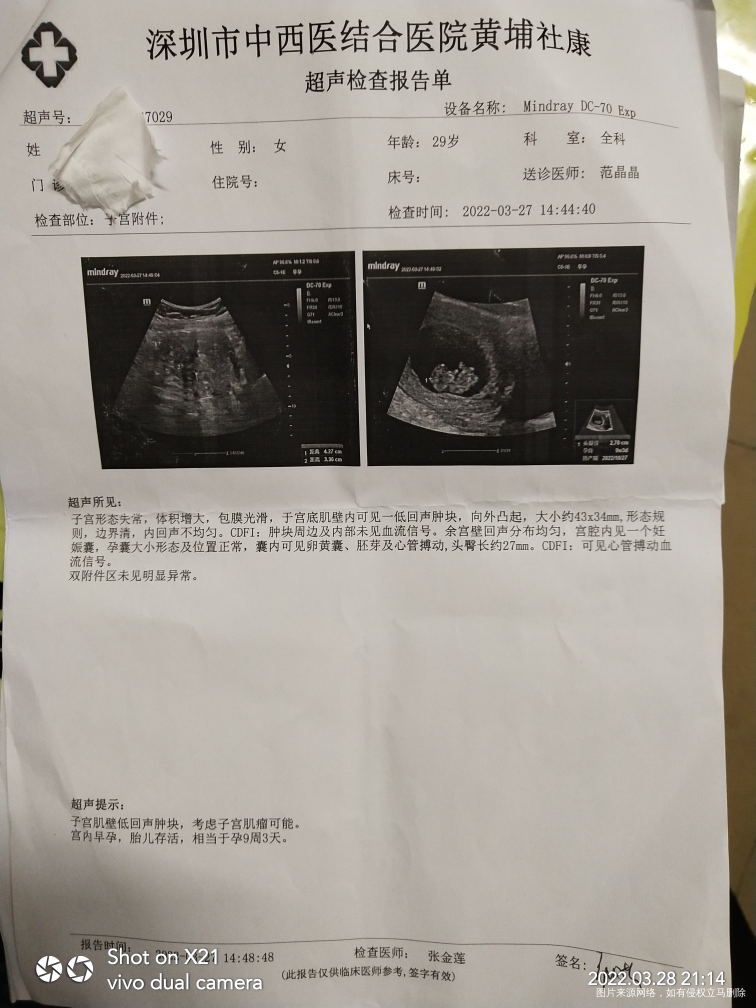 帮我解释一下这B超单问题![/stora