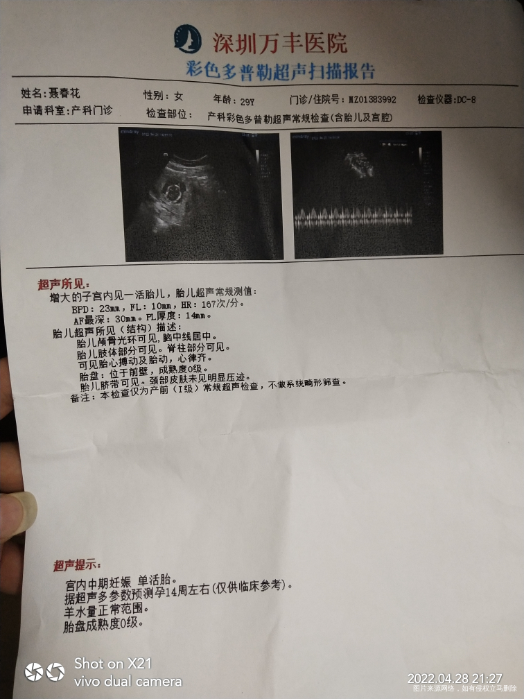 各位医生帮我看看这B超单有什么问题。这些我也看不懂,这B超单。