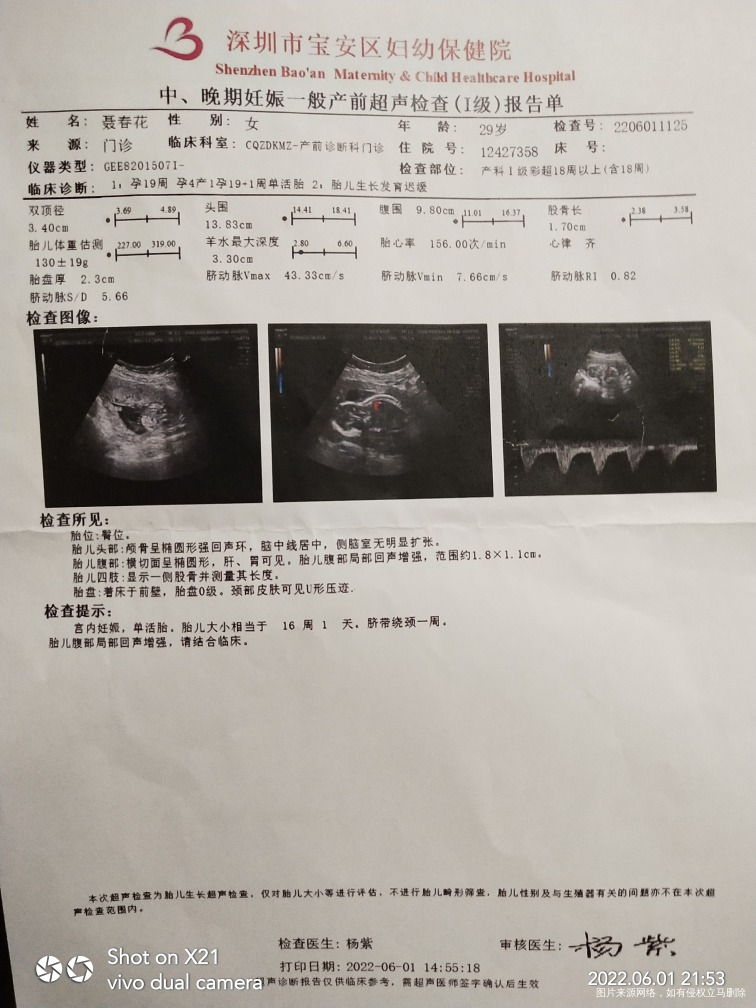 各位医生帮我分析一下或建议我怎么办,孕14周B超相符,孕19周B超显示小三周与实...