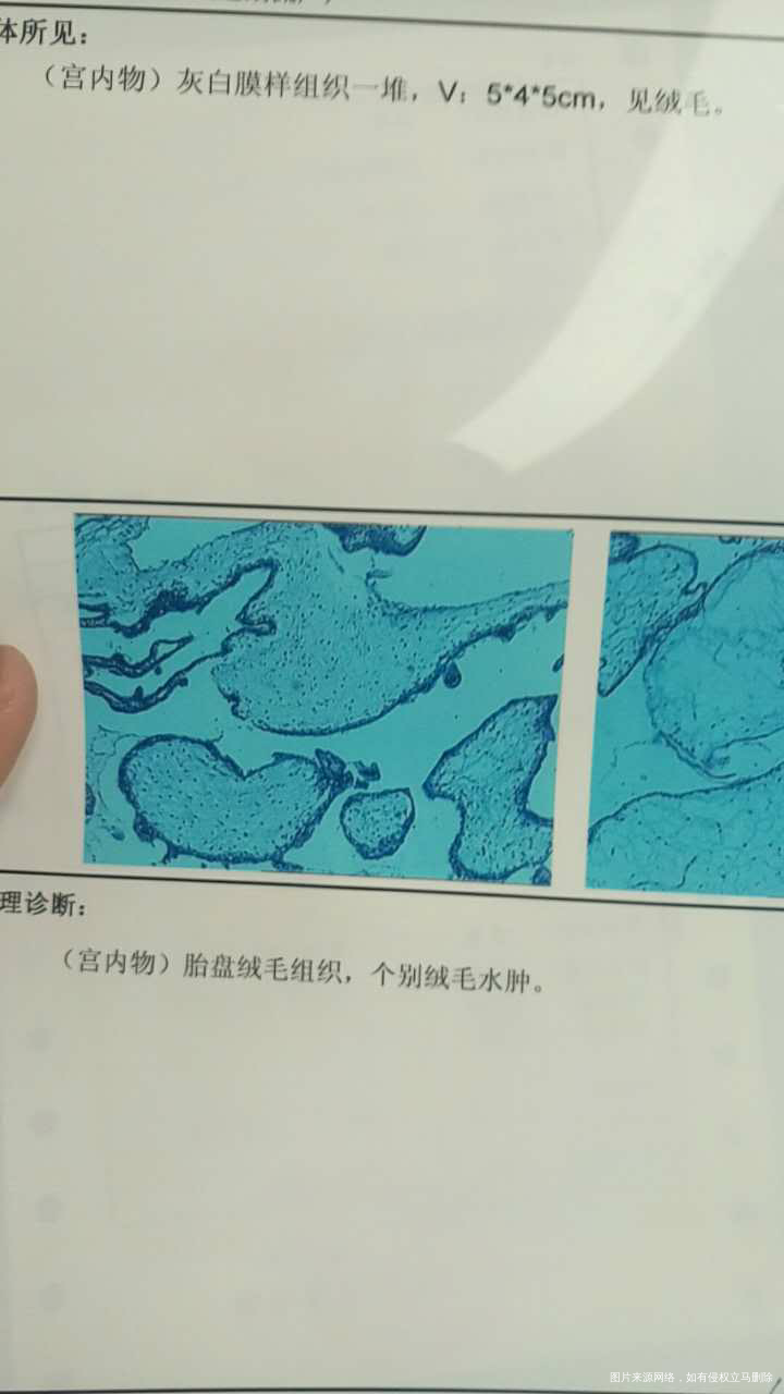 急急急,求助医生帮忙看看