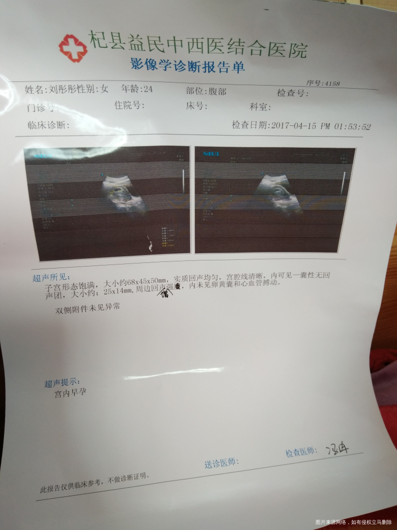 医生帮我看看这是怎么回事