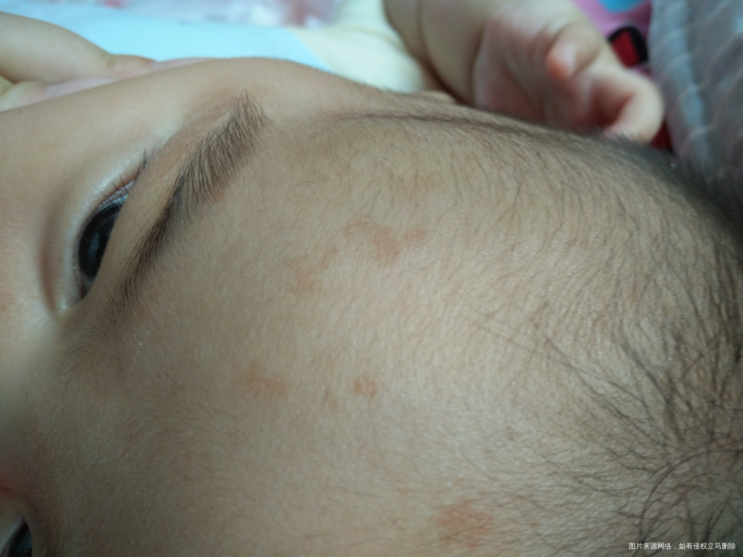 胎记还是什么帮着看看