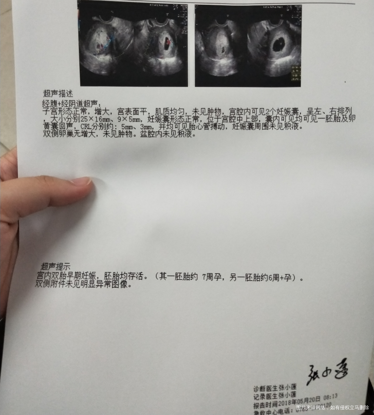 今天一超,成功了,不过还是担心