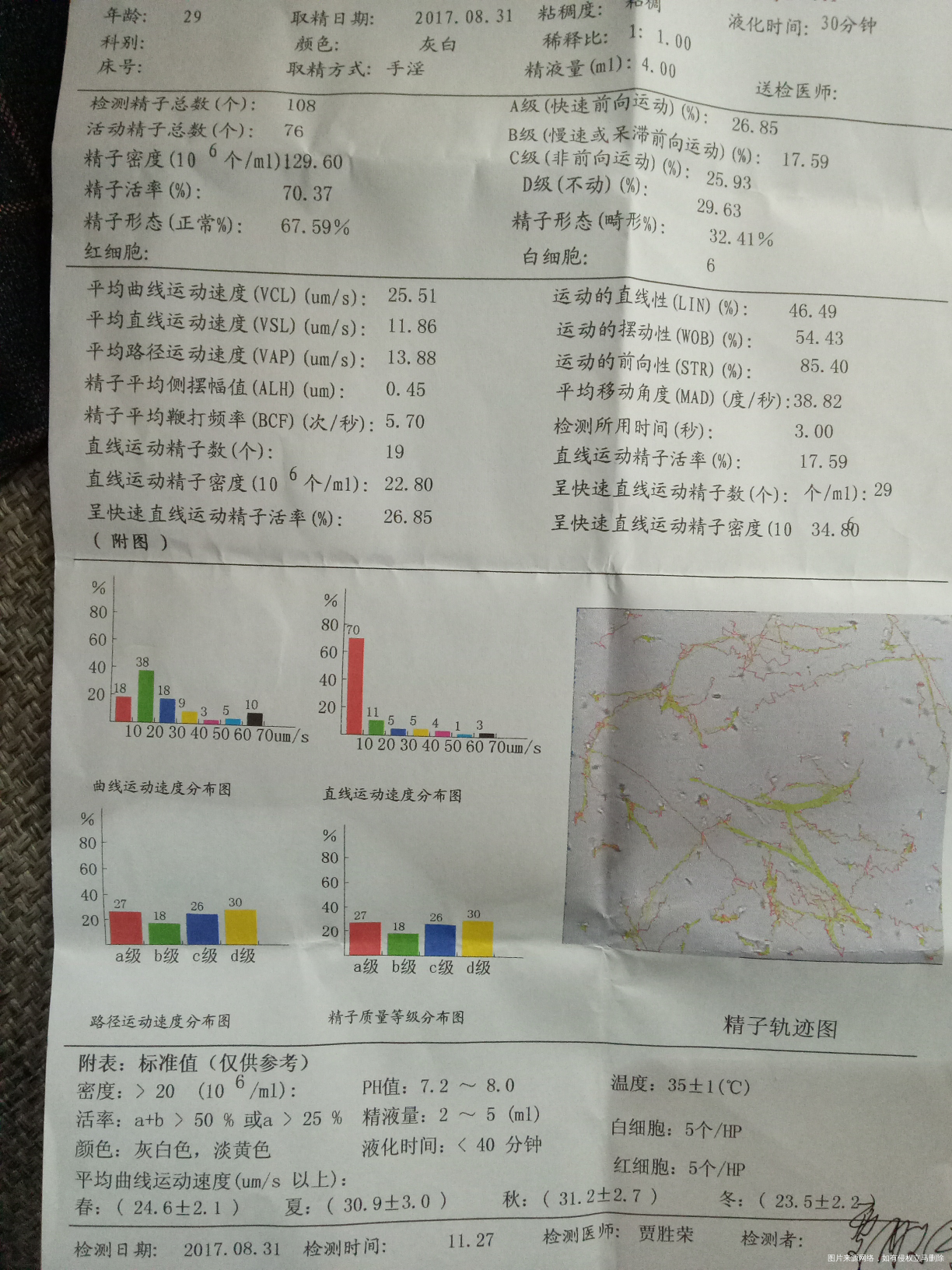 今天去医院检查精子,请医生帮忙看看