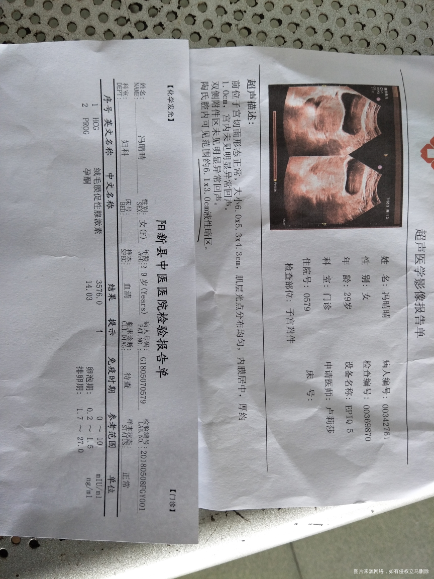 怀孕了,医生说陶氏腔积液,