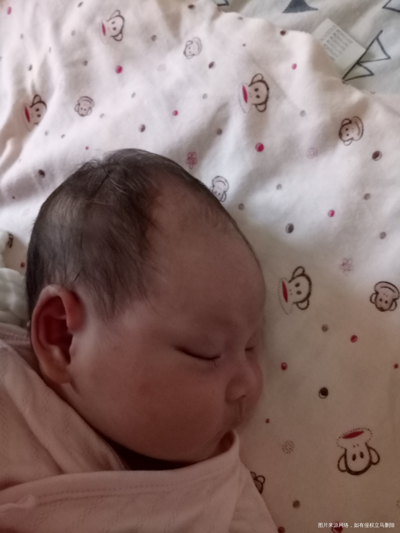 剖宫产孩子的头特别长怎么回事