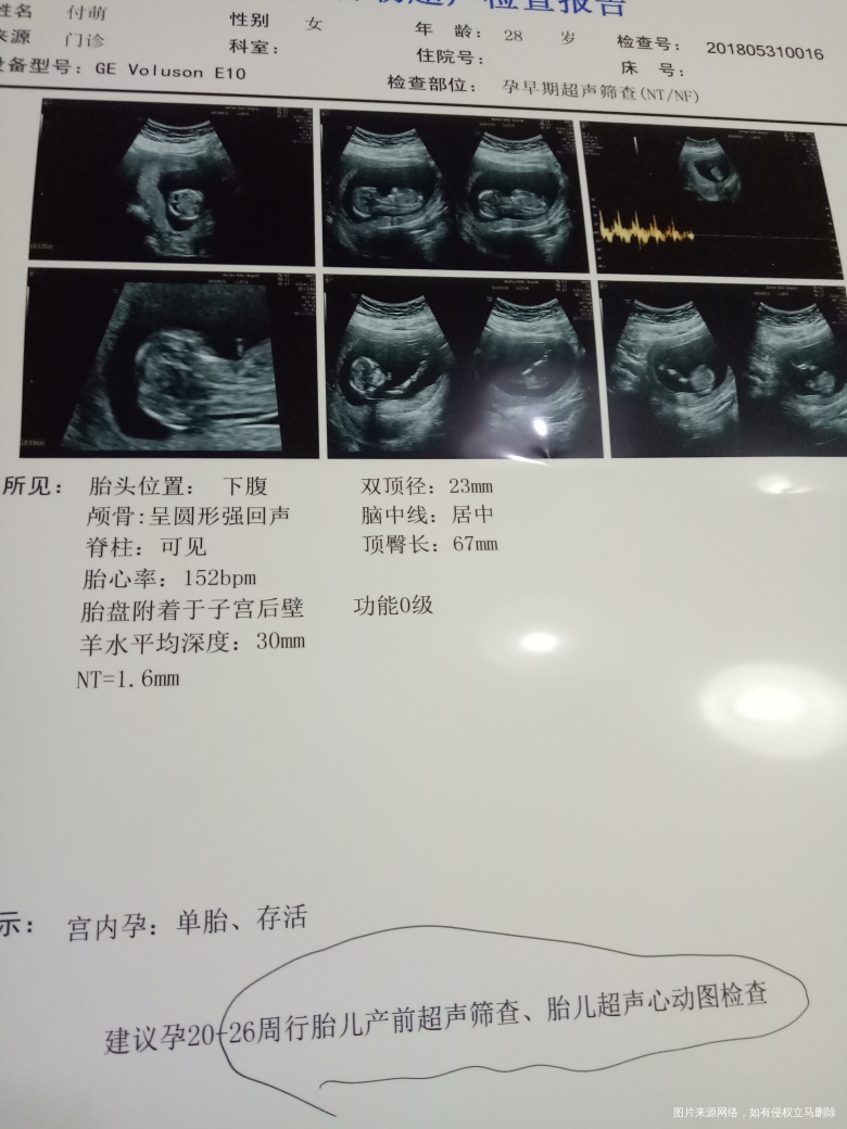 NT秒过,帮我看下我的NT,