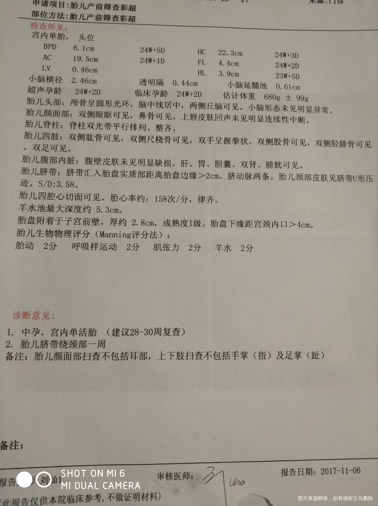 四维检查单24+2,胎盘成熟一级