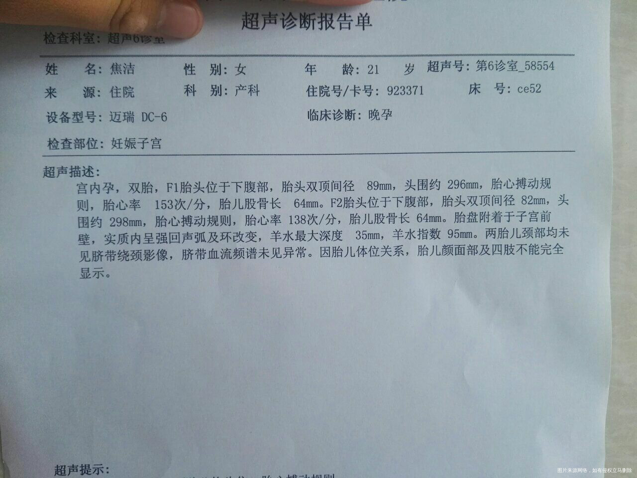 请各位医生帮忙看下羊水是否正常,两个胎儿分别有多重了,谢谢