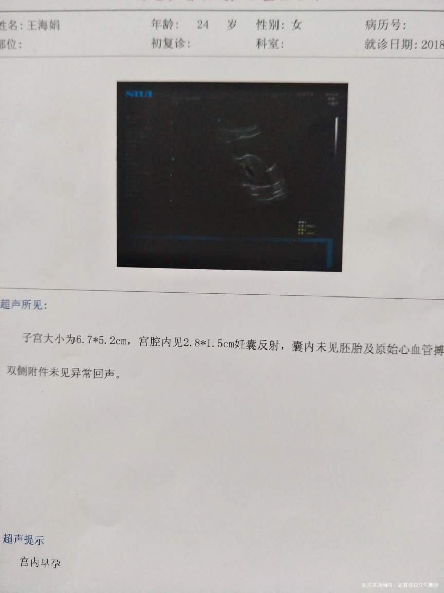 帮忙看看男女哈哈哈 顺便看看正常吗