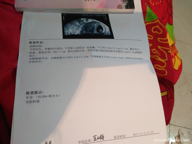 大家一起来猜猜男女宝贝!