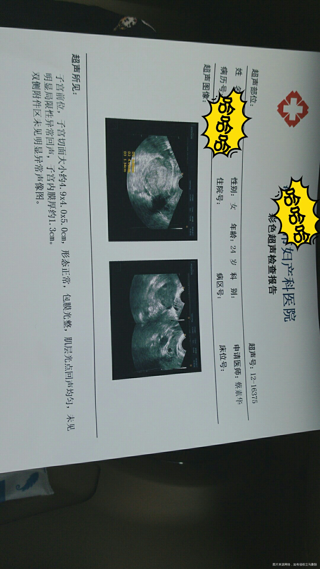 求助 内膜已经1.3了为什么到现在月经还没来