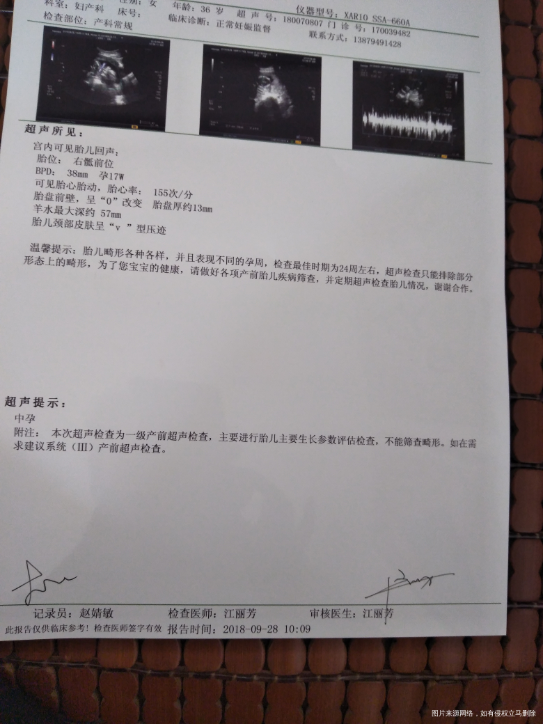 今天16周多去检查唐筛和b超,医生不在,请帮忙看看,