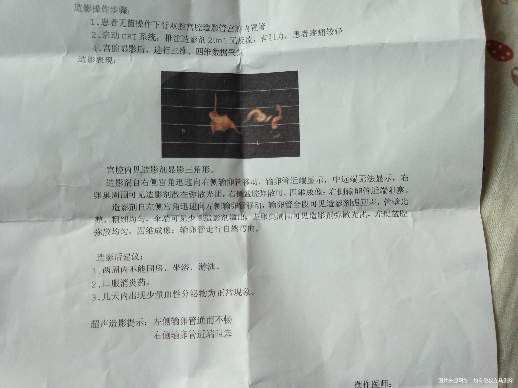 输卵管右侧近端堵塞,左侧通而不畅只能做腹腔镜治疗么