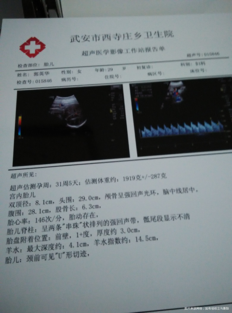 胎儿比实际孕周小两周怎么办?