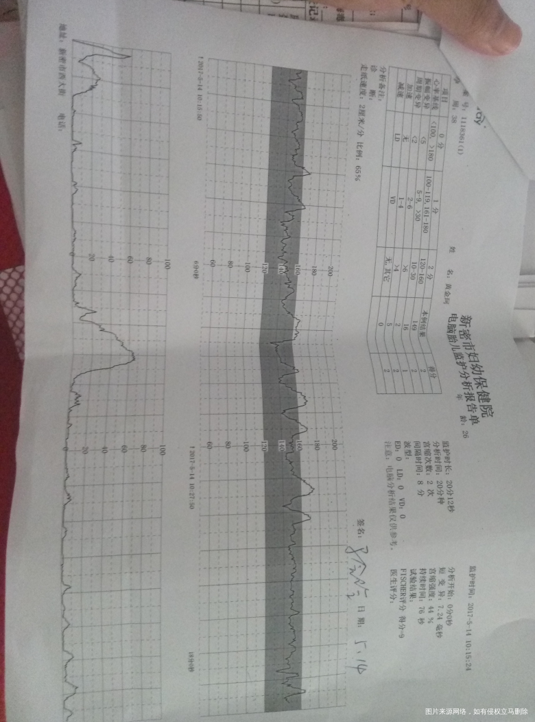 我38周,彩超显示羊水指数76,要不要住院催生呢?