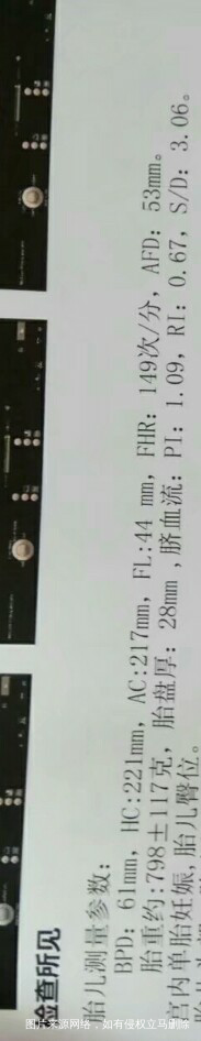 医生帮我看看胎儿多重?