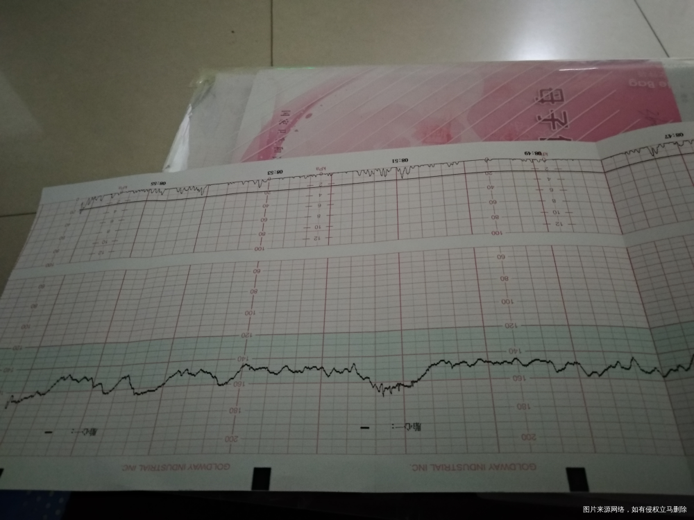 宝贝,是不是妈咪这几天在和你说话起到效果了,这次这么配合妈咪!真的好难得呀!相信...