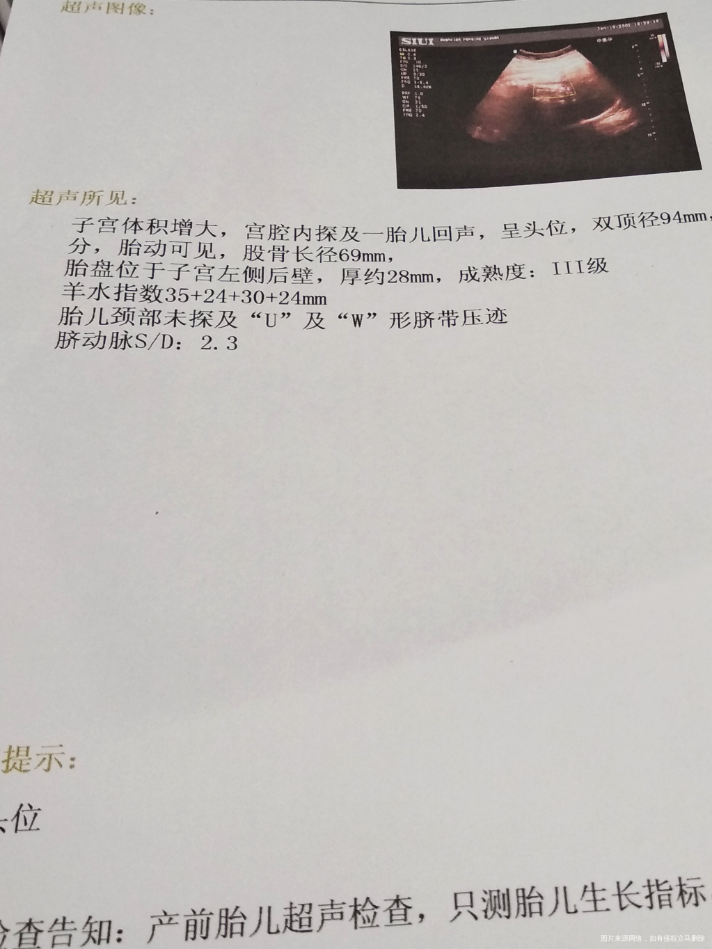 宝贝,你今天上午有点吓到妈咪了,做胎监的时候不配合!下午去复查的时候刚开始又不配...