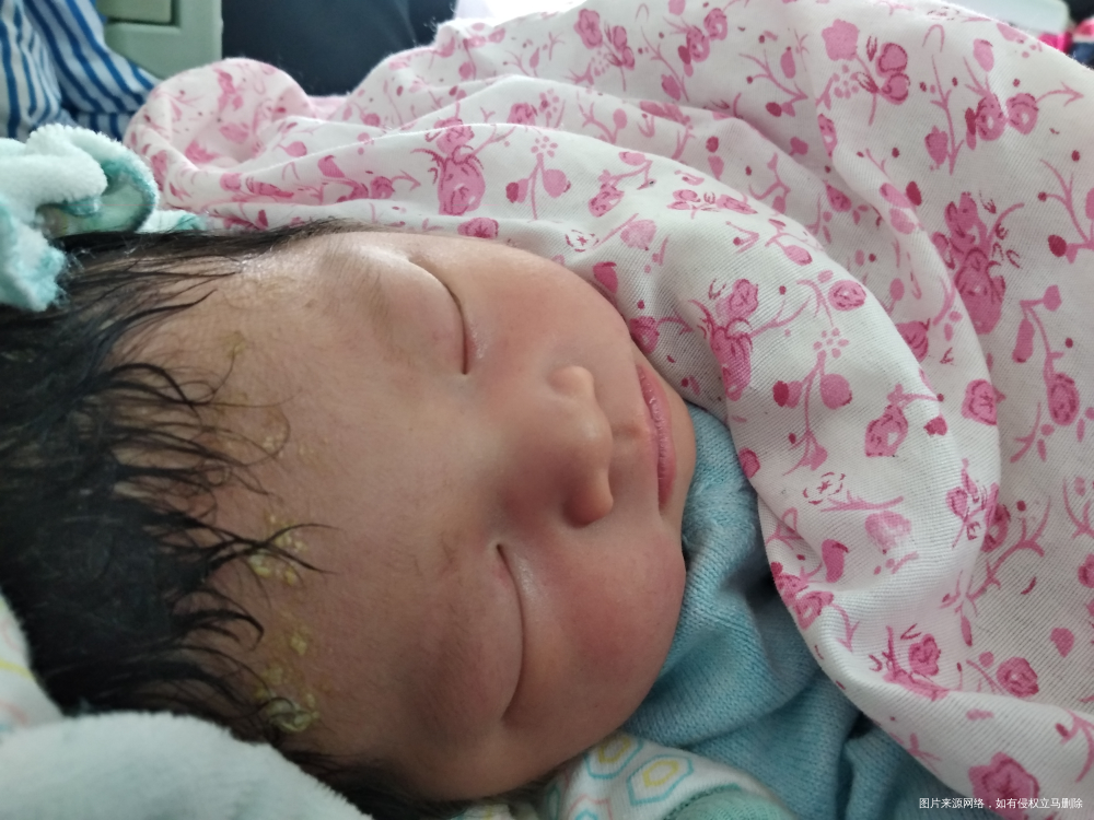 4月21日上午10点零一分剖腹产一枚6.6斤,女宝一枚! ...