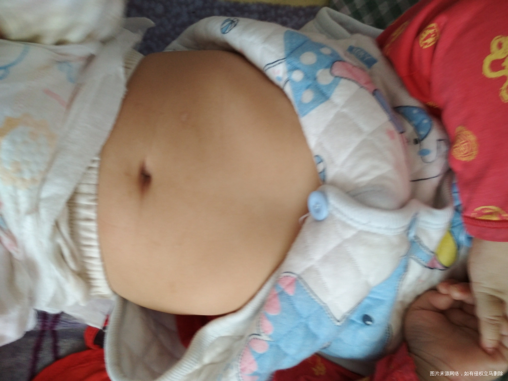 宝宝八个月体检,医生看了宝宝肚子说有点肋骨外翻