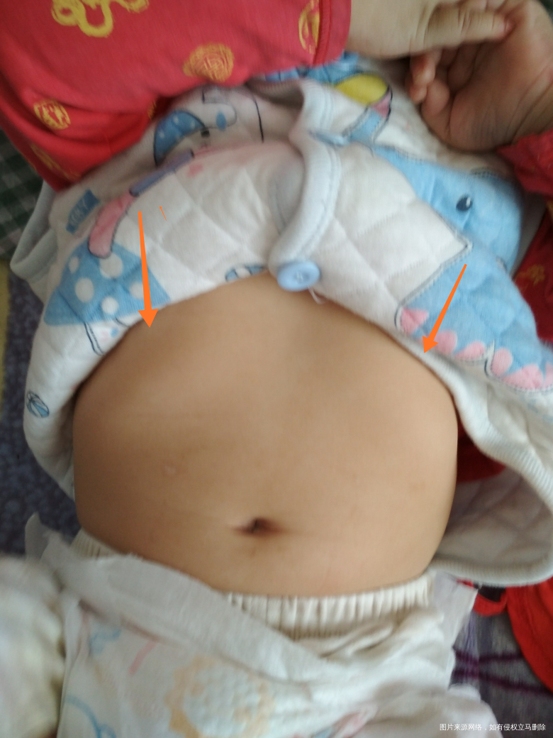 宝宝八个月体检,医生看了宝宝肚子说有点肋骨外翻