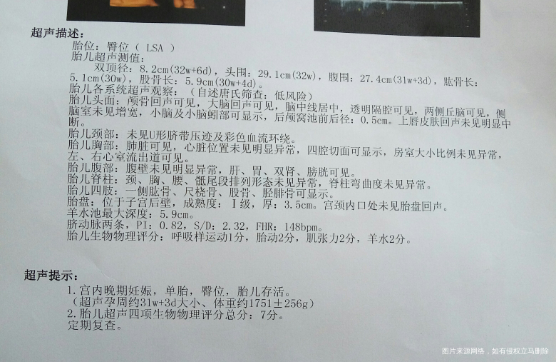 麻烦帮我看看,b超单,宝宝是偏大还是偏小?