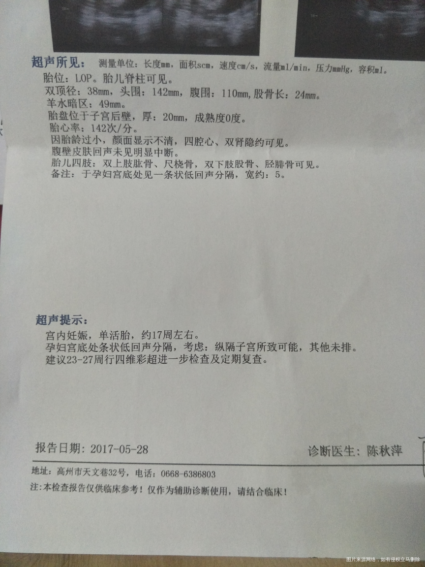 帮忙看看,对宝宝有影响吗?第一胎