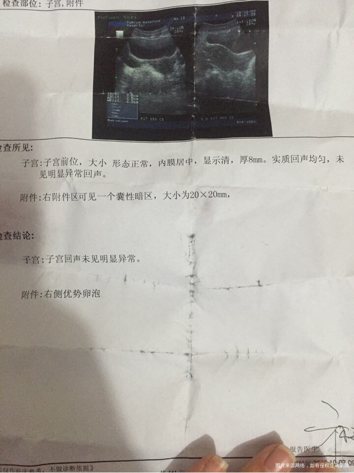 排卵正常吗,为什么一年都怀不上