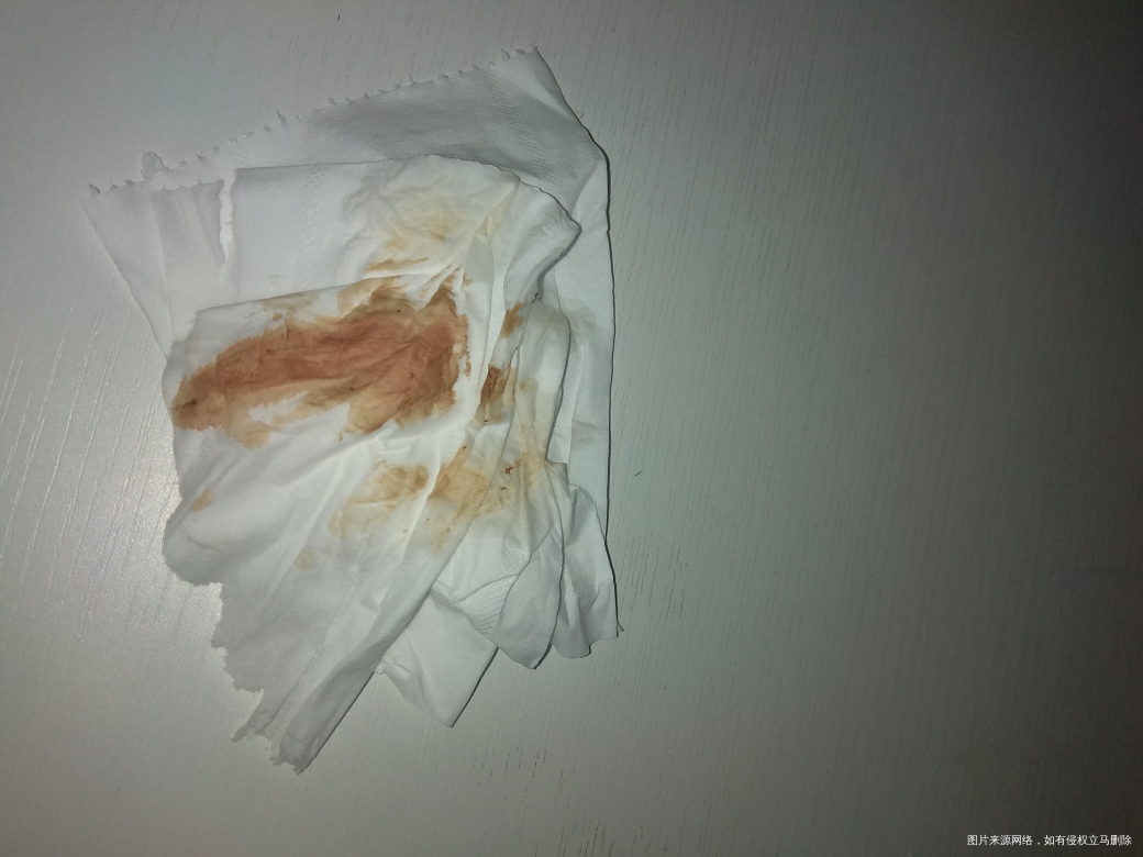 39+4,姐妹们这是见红吗?第一胎是破水,没见红,没经验