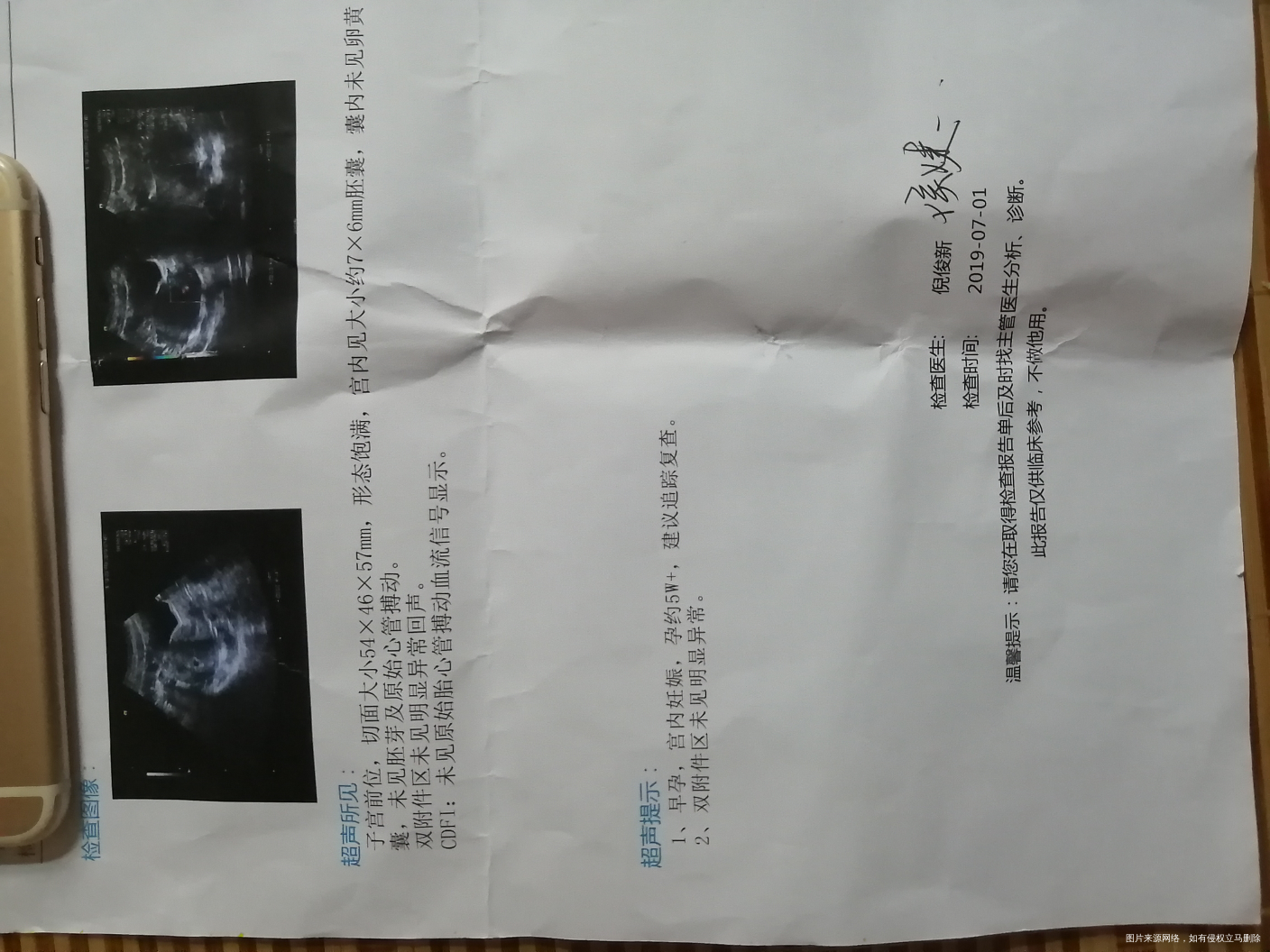 您好,医生,这样的情况需要去医院检查吗