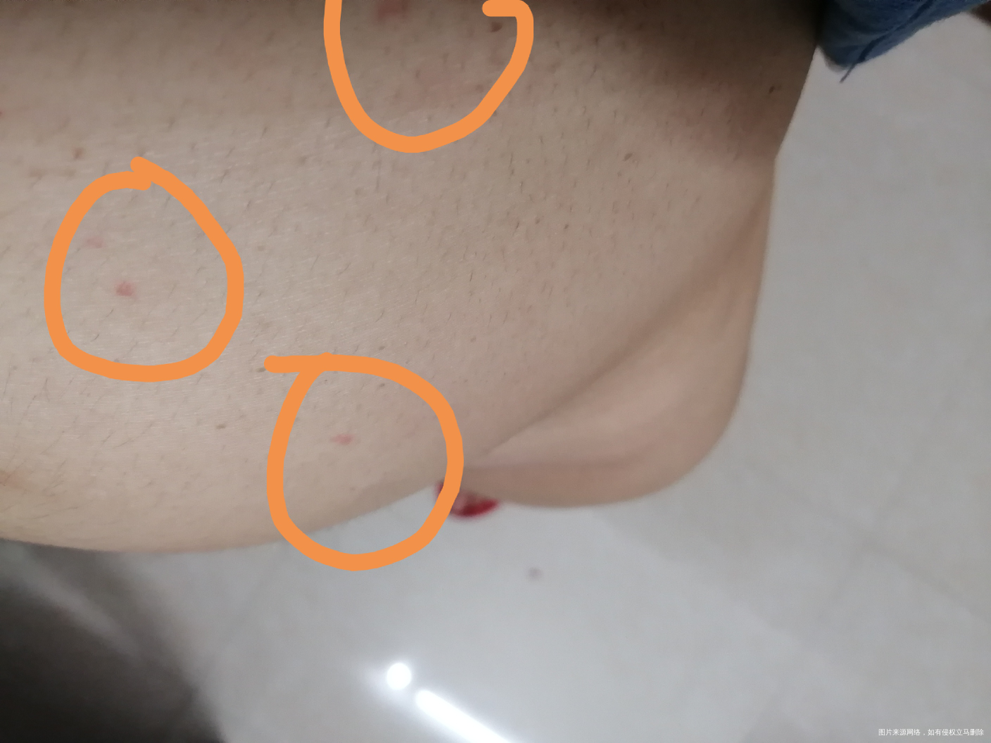 医生帮忙看看,肚子上长这些红点,是什么