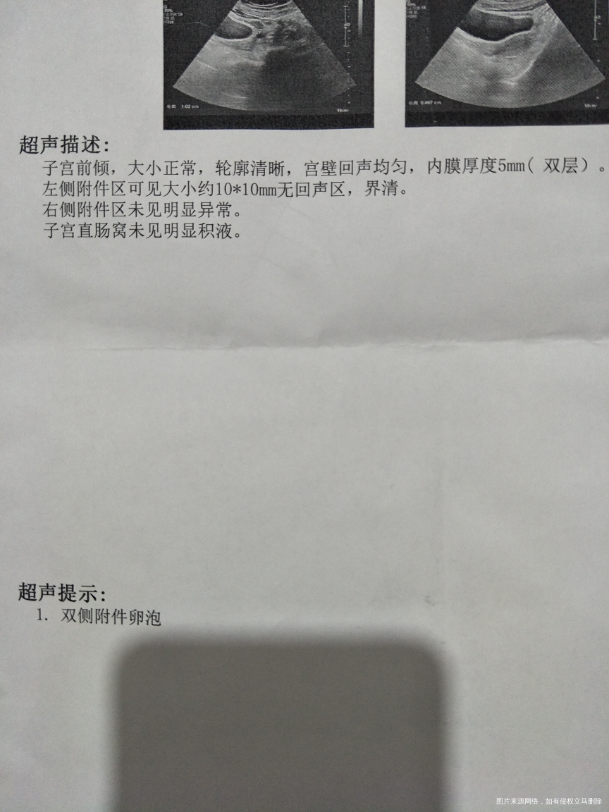 这样是不是说明卵泡在长啊,