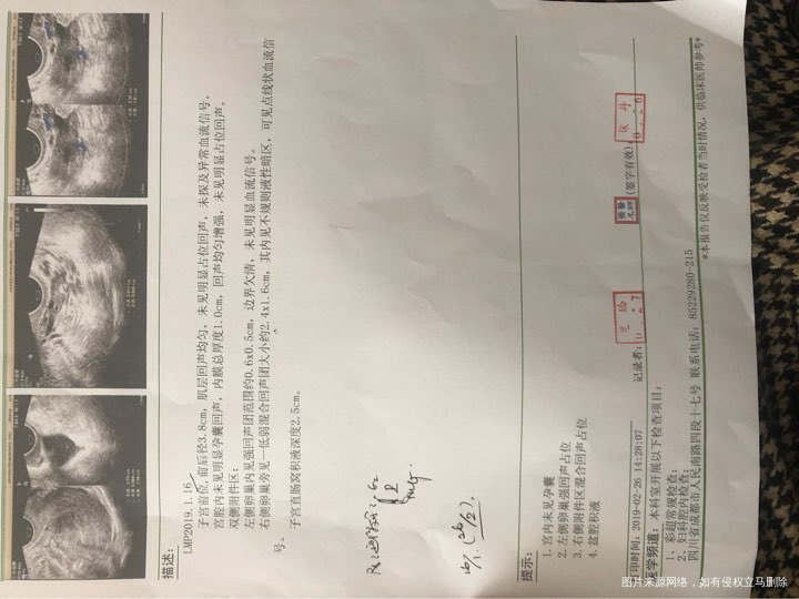 
21号早早孕验到有一点点印记,25号才看到一条粉色的,今天腹痛去医院打了一个B…