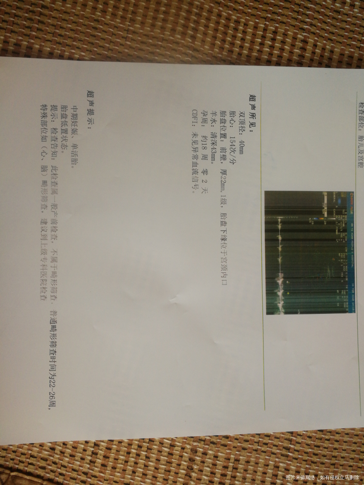 上次14周5天,胎盘低置,今天去复查,还是低置,哎,什么时候才能长上去
