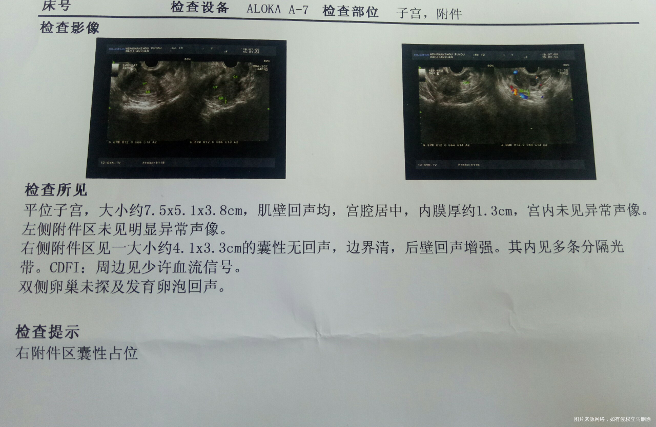 HEALTH-9000J B型超声诊断仪 HEALTH-9000J - 上海寰熙医疗器械