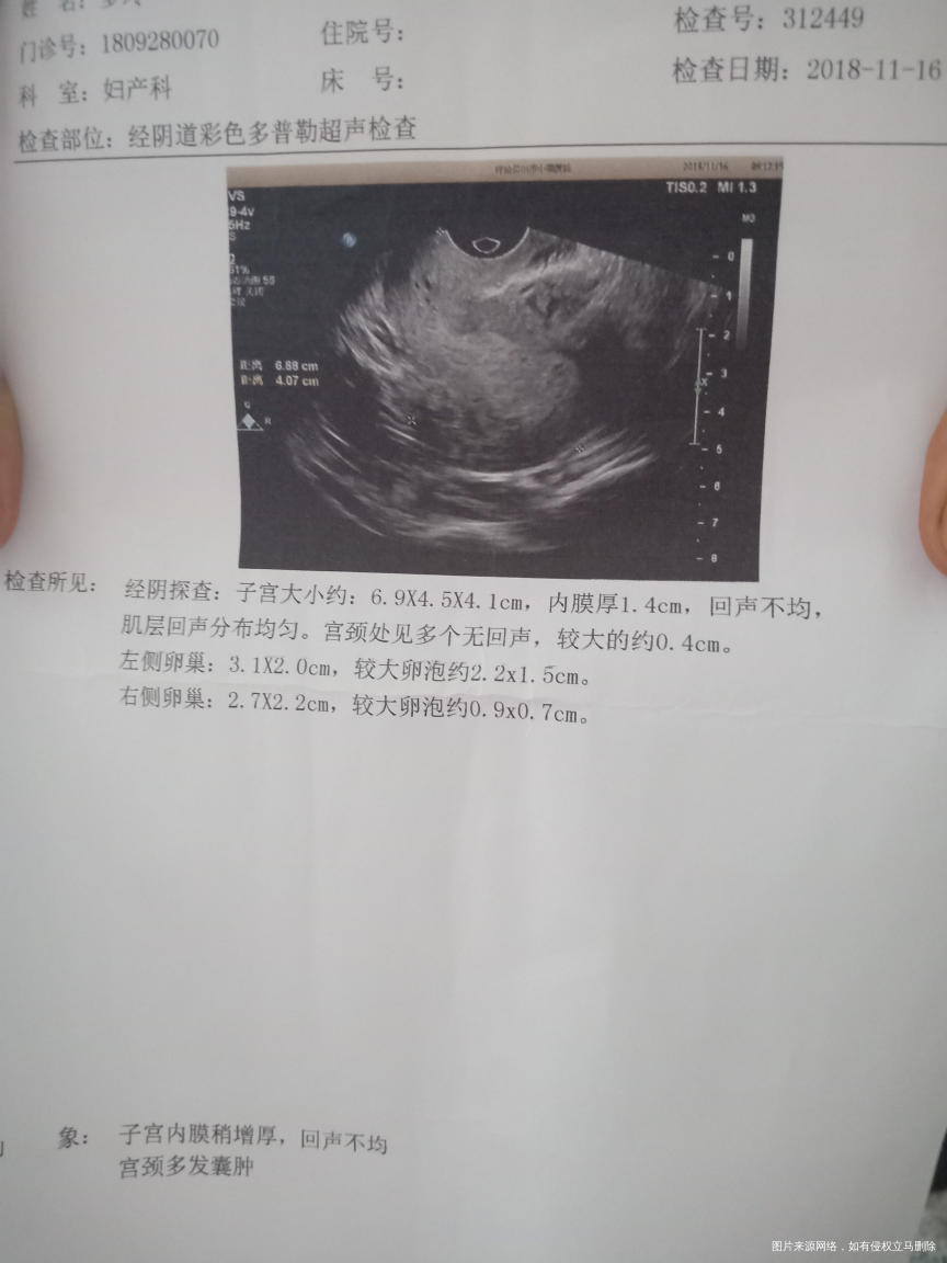 没有促排卵针吃排卵药可不可以