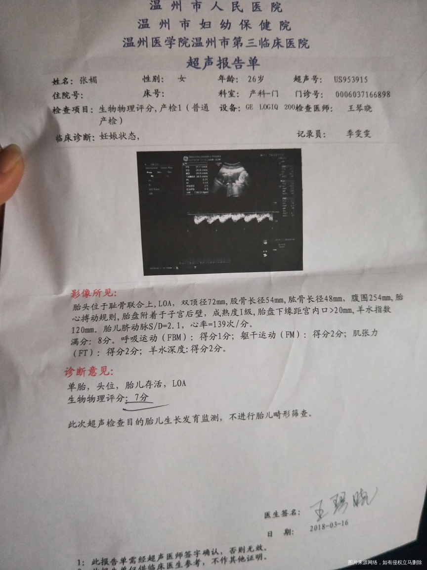 请医生帮我看看B超谢谢谢谢