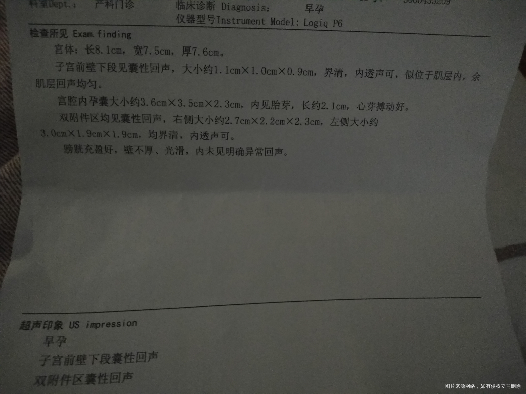 怀孕9周,B超单检查正常吗?