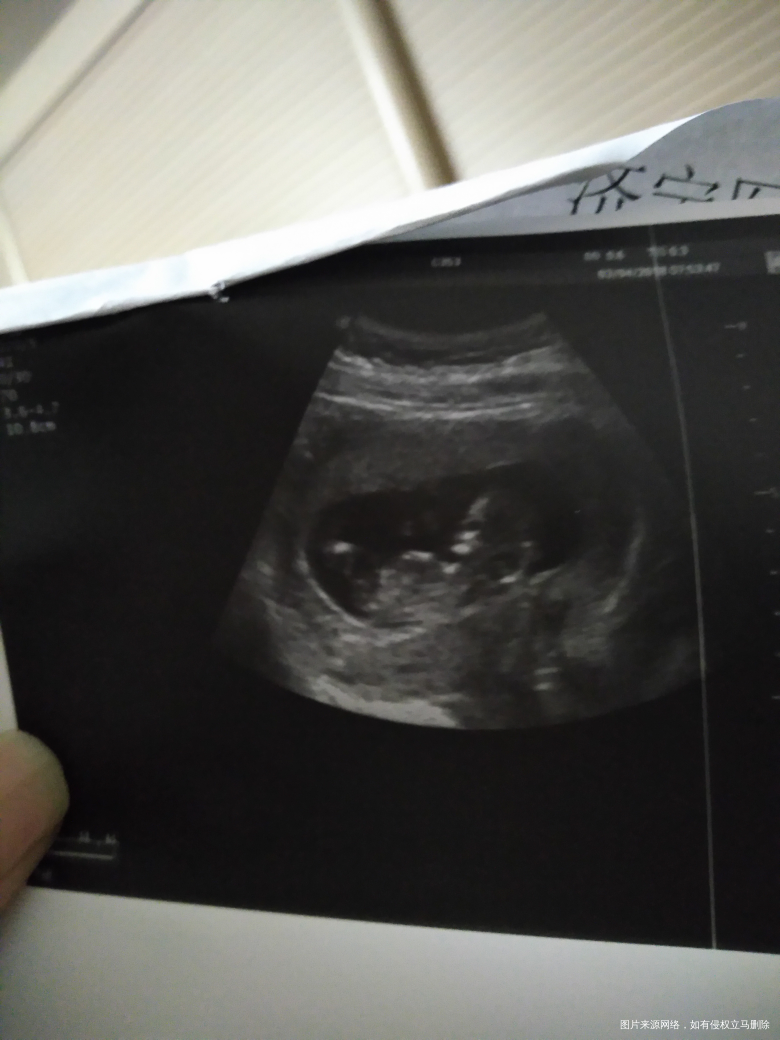 怀孕12周+3还用继续吃孕酮和叶酸吗