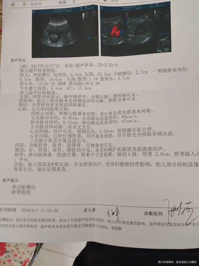 今天做了大排畸,帮忙看看正常吗